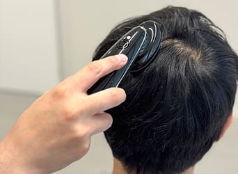 当院独自の発毛施術
